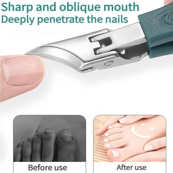 🔥Last Day Sale - 49% OFF🔥Eagle Beak Angled Nail Clippers 3-Piece Set